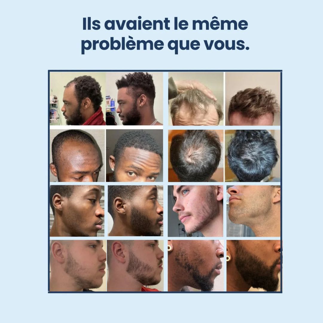 VitaRoll - Sérum de croissance